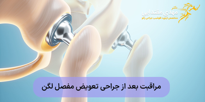 مراقبت بعد از جراحی تعویض مفصل لگن
