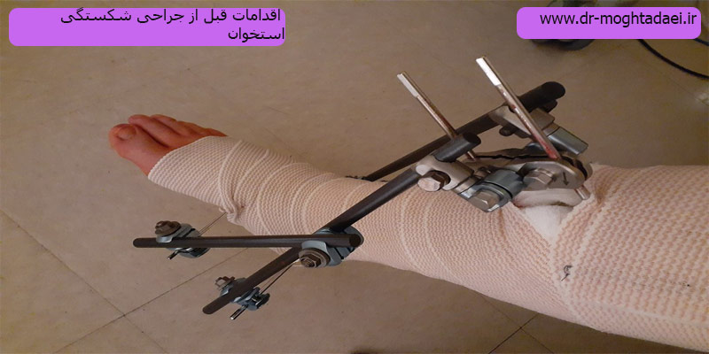 اقدامات-قبل-جراحی