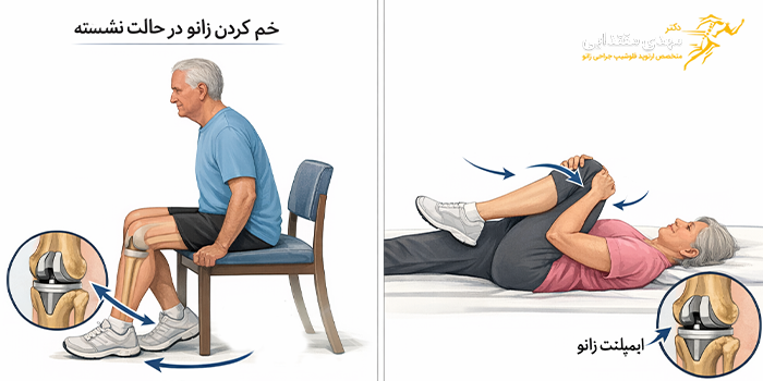 علت صاف نشدن زانو بعد از تعویض مفصل زانو