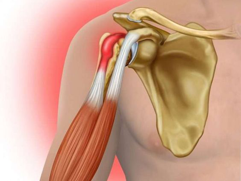 آیا عوارض تعویض مفصل شانه خطرناک است؟