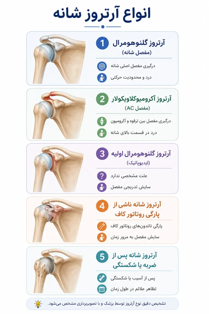 انواع آرتروز شانه