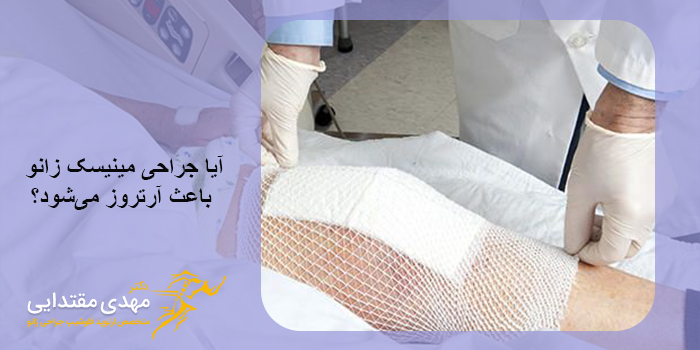 چگونه عوارض بعد از جراحی مینیسک زانو را کاهش دهیم؟