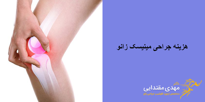 هزینه جراحی مینیسک زانو