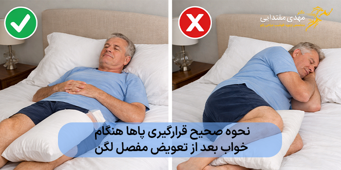 نحوه صحیح قرارگیری پاها هنگام خواب بعد از تعویض مفصل لگن