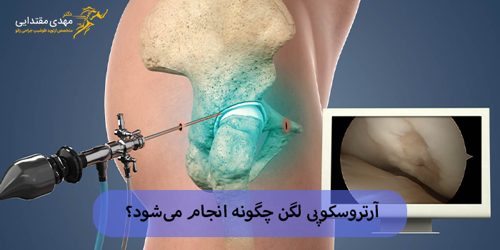 آرتروسکوپی لگن