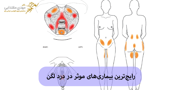 رایجترین بیماریها موثر در درد لگن