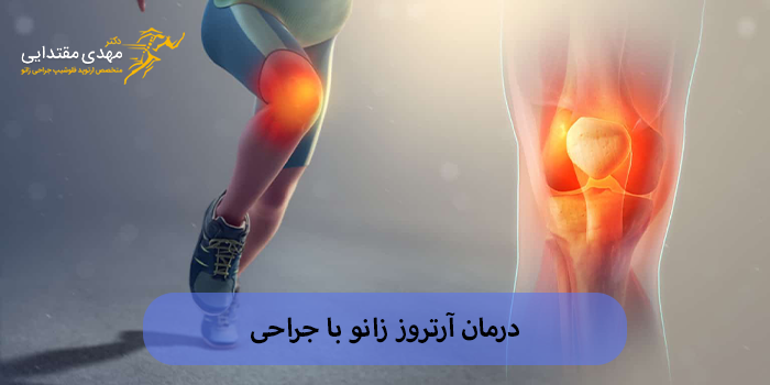 درمان آرتروز زانو با جراحی